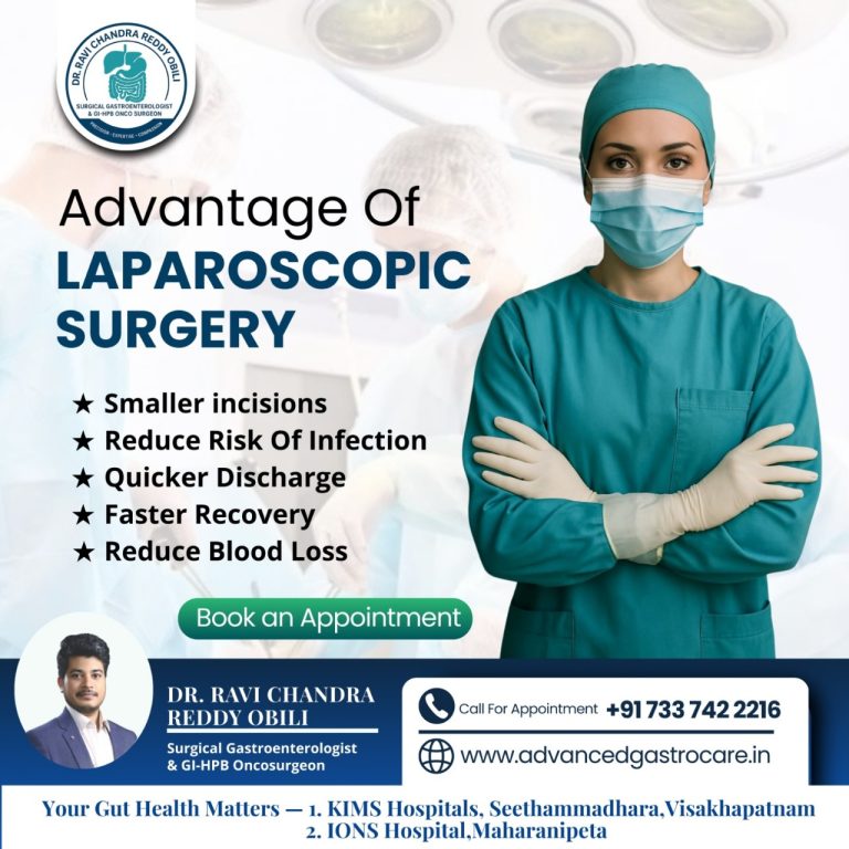 Laparoscopic Surgery Dr Ravichandra reddy Obili